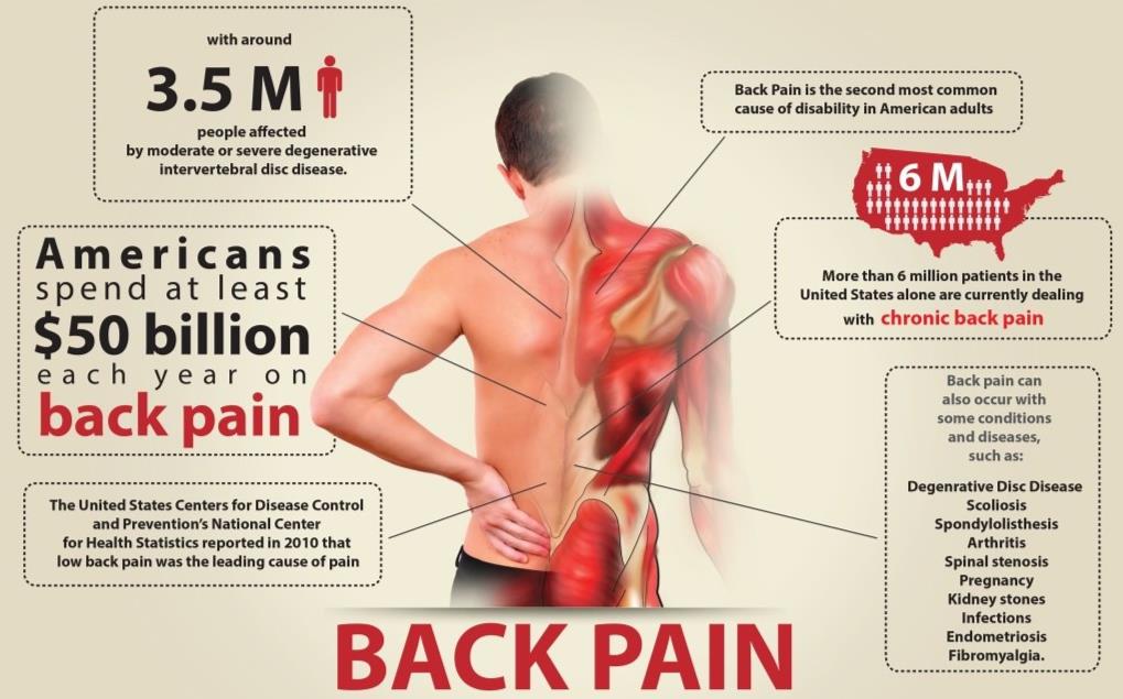 Back Pain in America Infographic SaferCures.com Image Source Flicker