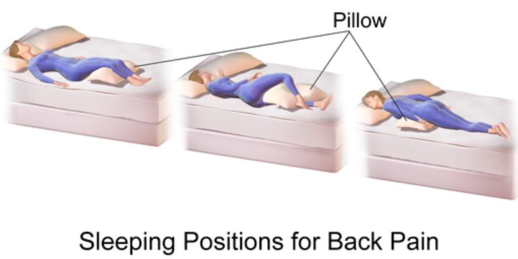 Sleeping Positions for Back Pain Image source: Creativecommons.org via Wikimedia Commons SaferCures.com