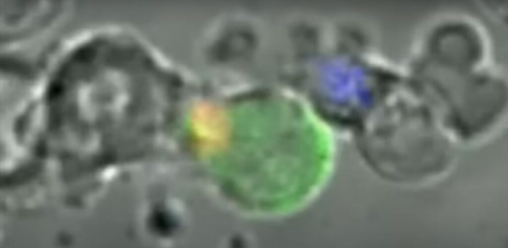 Alternative Cancer Treatments Activated T cell destroys Cancer cells, Image credit: University of San Francisco video SaferCures.com