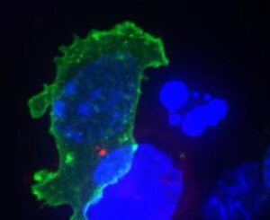 Killer T Cell (green) attacking cancer cell (bottom). Image credit: Cambridge U. video SaferCures.com