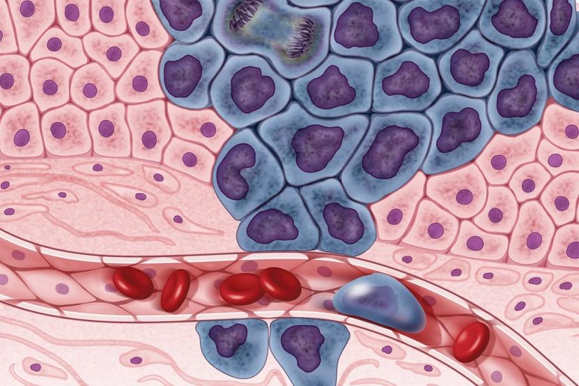 Cancer Cells Image Source: flickr Safercures.com