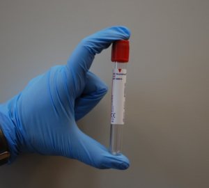 Blood Labs Source: Pxhere.com Safercures.com